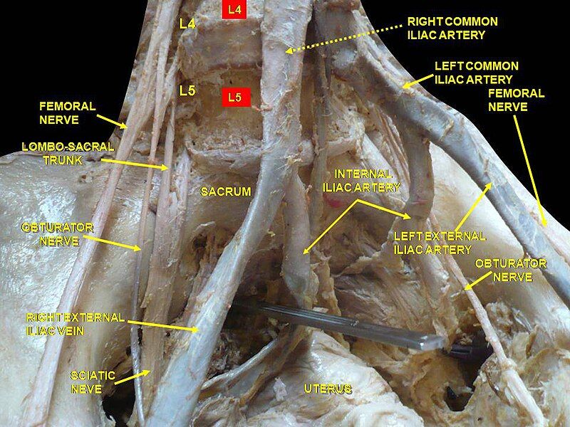 File:Slide3erer.JPG