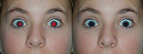 A photograph of a human with the red-eye effect and its correction right next to it