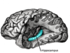 Diagram of the brain with the hippocampus highlighted