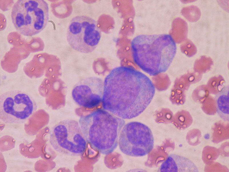 File:Bone marrow WBC.JPG