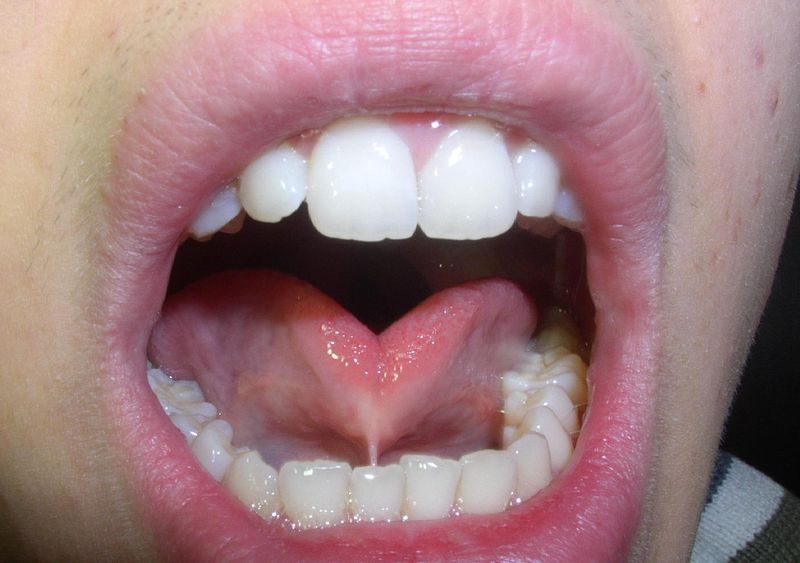 File:Frenulum linguae.jpg