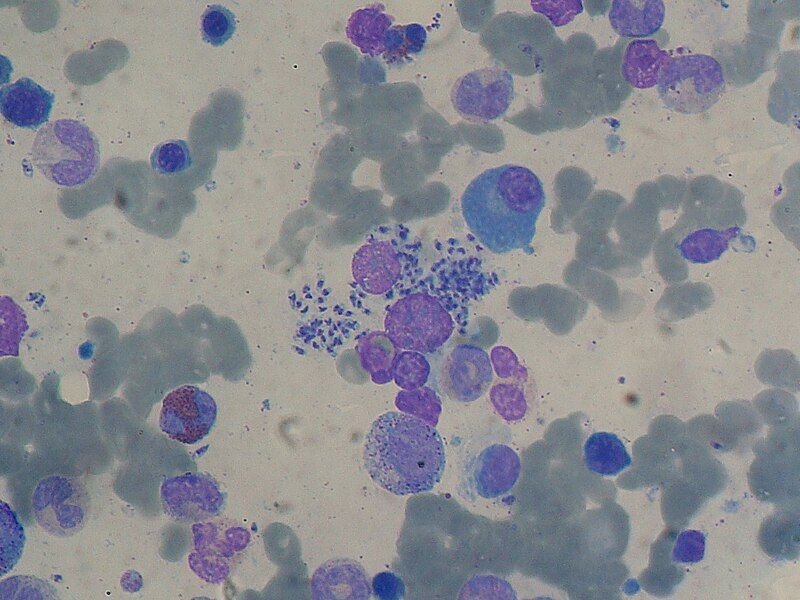 File:Leishmania 2009-04-14 smear.JPG