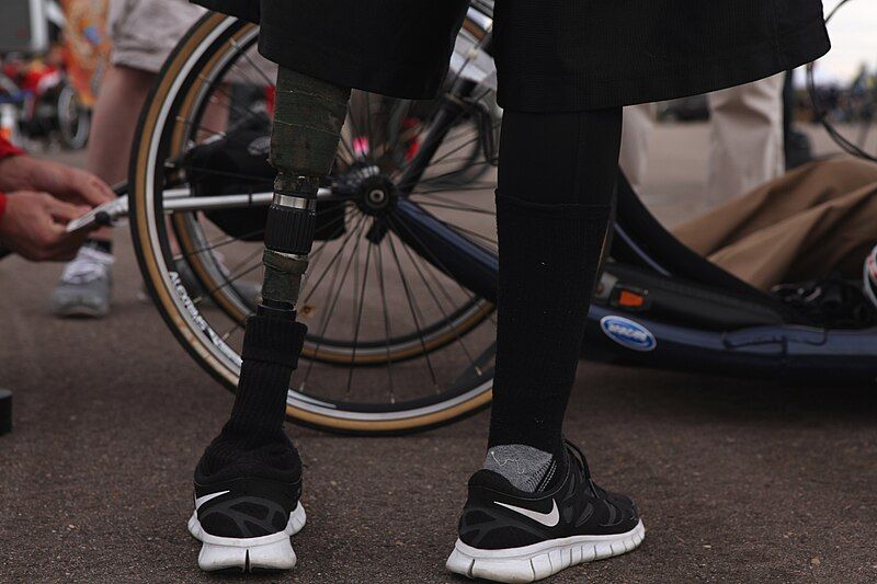 File:Prosthetic leg cycling.jpg