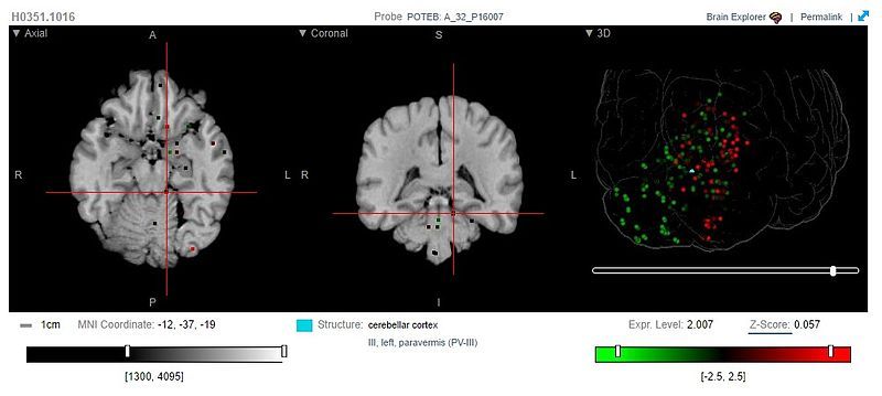 File:POTEB Brain Atlas.jpg