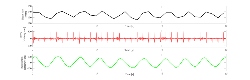 File:RSA neonatal ECG+RESP+HR.png