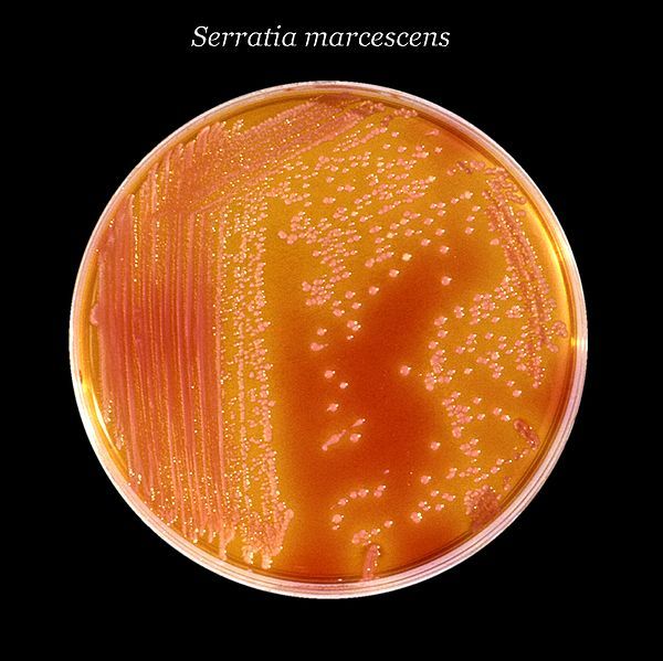 File:Serratia marcescens 01.jpg