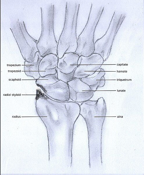 File:Stadium1osteoarthritis.JPG