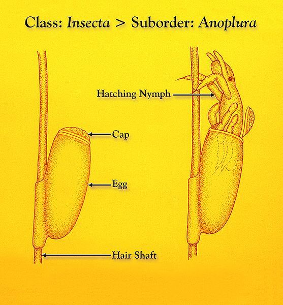 File:Anoplura hatching.jpg