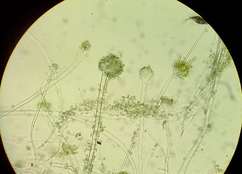 File:Aspergillus oryzae.jpg