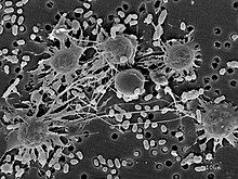 Amoebal and cystic cells of Parvularia atlantis