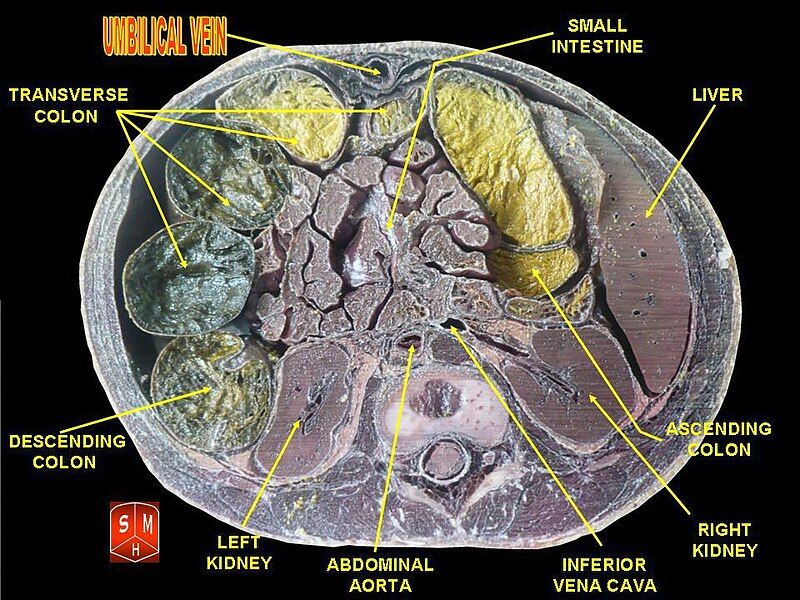 File:Umbilical vein.jpg