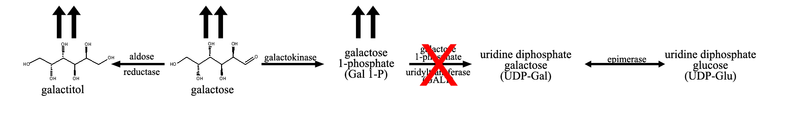 File:Galactose Metabolism GALT.png