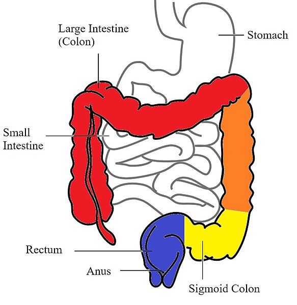 File:Classification of Colitis.jpg