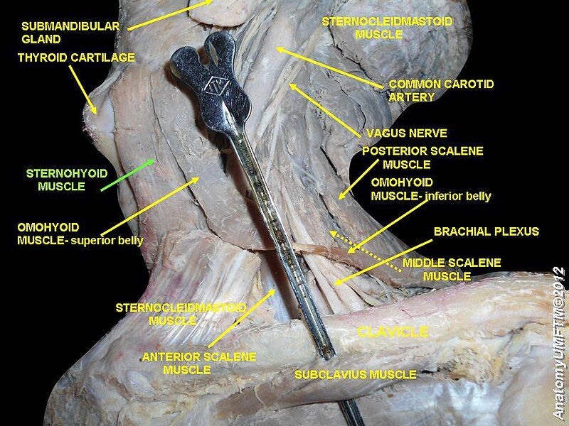 File:Slide3b.JPG