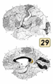 Brodmann area 29