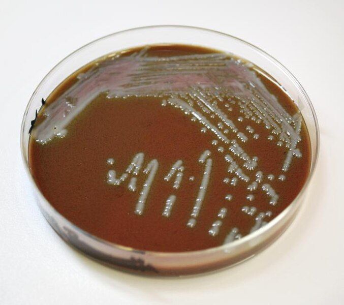 File:Chocolate agar 1.jpg