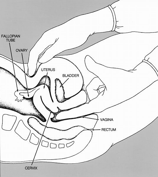 File:Pelvic exam nci-vol-1786-300.jpg