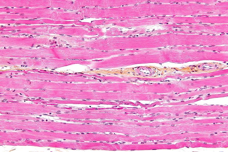 File:Skeletal striated muscle.jpg