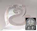 Coronal section of hippocampus. Parahippocampal gyrus labelled at bottom.