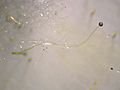 Phycomyces blakesleeanus asexual sporangium