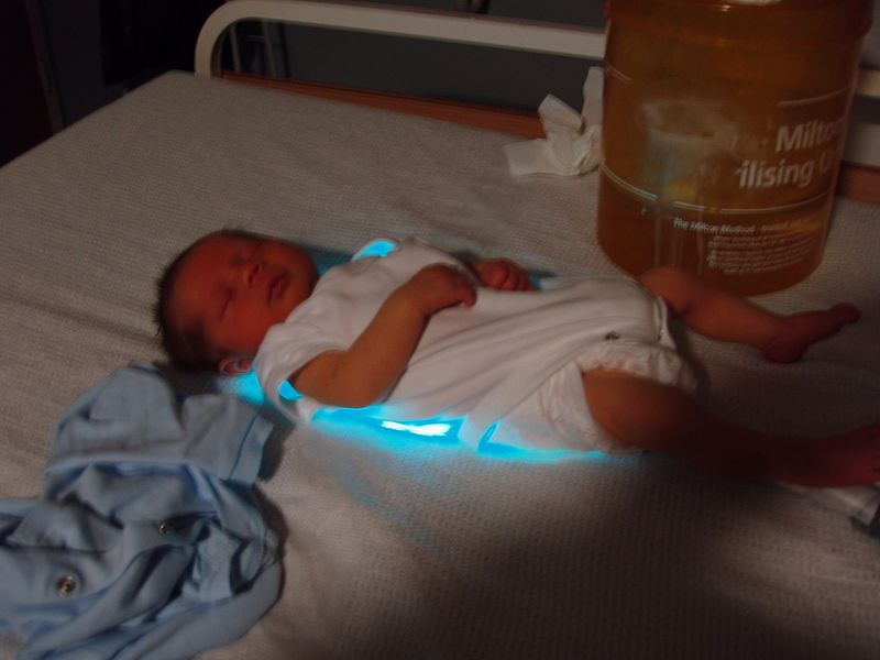 File:Baby BiliBlanket Treatment.jpg