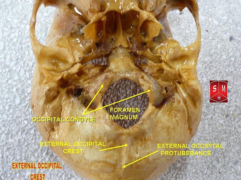 File:External occipital crest.jpg