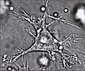 A dendritic cell