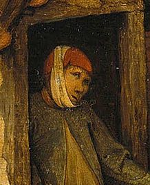 The phrase "to complain of a toothache behind the ears" refers to fictitious pain complaint, as may be used by a malingerer. Detail from Netherlandish Proverbs (Pieter Bruegel, 1559).