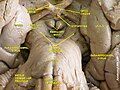 Optic nerve. Deep dissection. Inferior view.