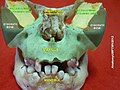 Greater wing of sphenoid bone