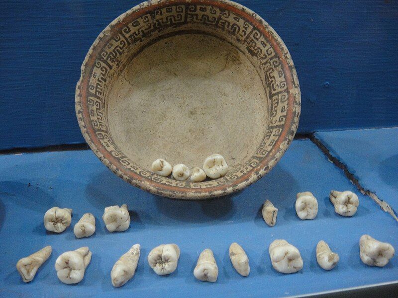 File:Ceramic & Teeth.JPG