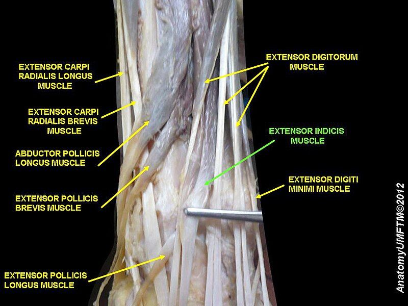 File:Slide14TTTT.JPG