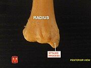 Radius, ulnar notch - posterior view