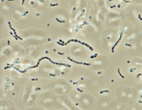 Streptococcus iniae, a Gram-positive, sphere-shaped bacteria caused losses in farmed marine and freshwater finfish of US$100 million in 1997.[51]