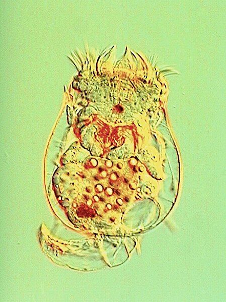 File:Brachionuscalyciflorus.jpg