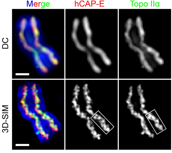 File:Chromosome scaffold summary.webp