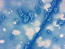 Microconidia of "Fusarium oxysporum" f. sp. "albedinis"; staining: lactophenol cotton blue; Host: "Phoenix dactylifera"