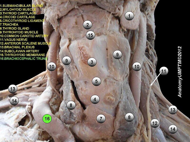 File:Slide15e.JPG