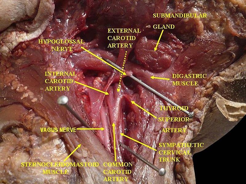 File:Slide1EBAB.JPG