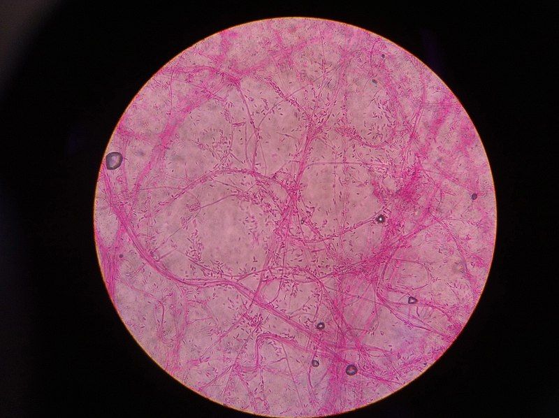 File:Lactofuchsin Mount.jpg