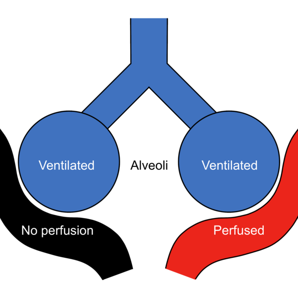 File:Alveolar dead space.png