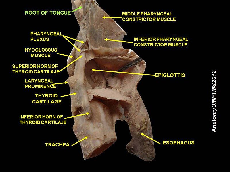 File:Slide1mmm.JPG