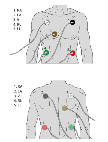 File:ECG Electrode Placement.png