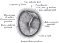 Right eardrum as seen through a speculum