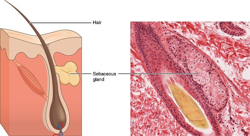 File:407 Sebaceous Glands.jpg