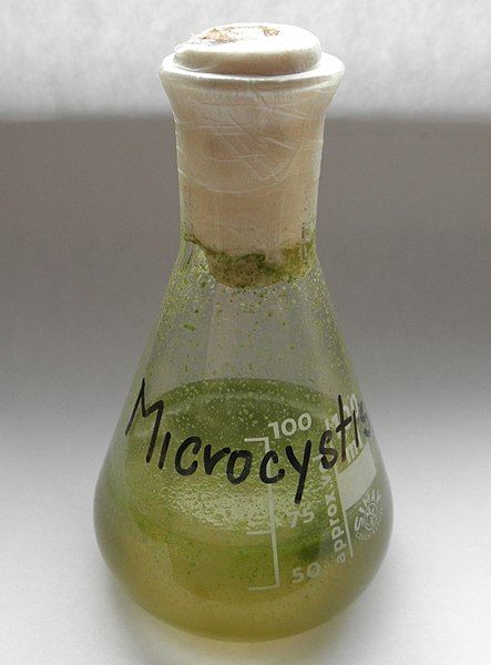 File:Microcystis 1.jpg