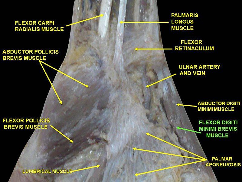 File:Slide6VVV.JPG