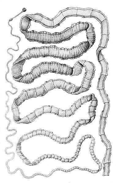 File:Taenia solium.jpg