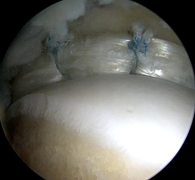 File:Reconlabrum.jpg