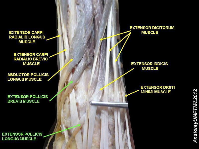 File:Slide12TTTT.JPG